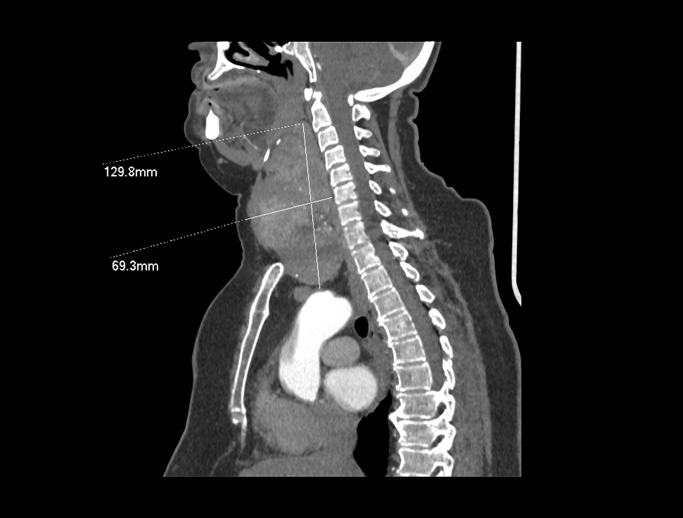 PX Img20231226095436