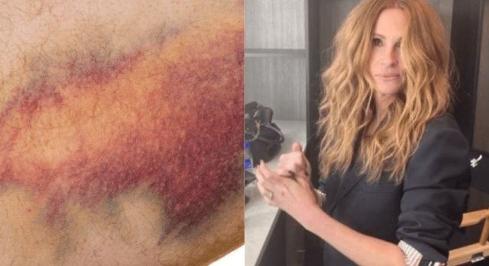 que enfermedad tiene julia roberts focus 0 0 640 384 edited