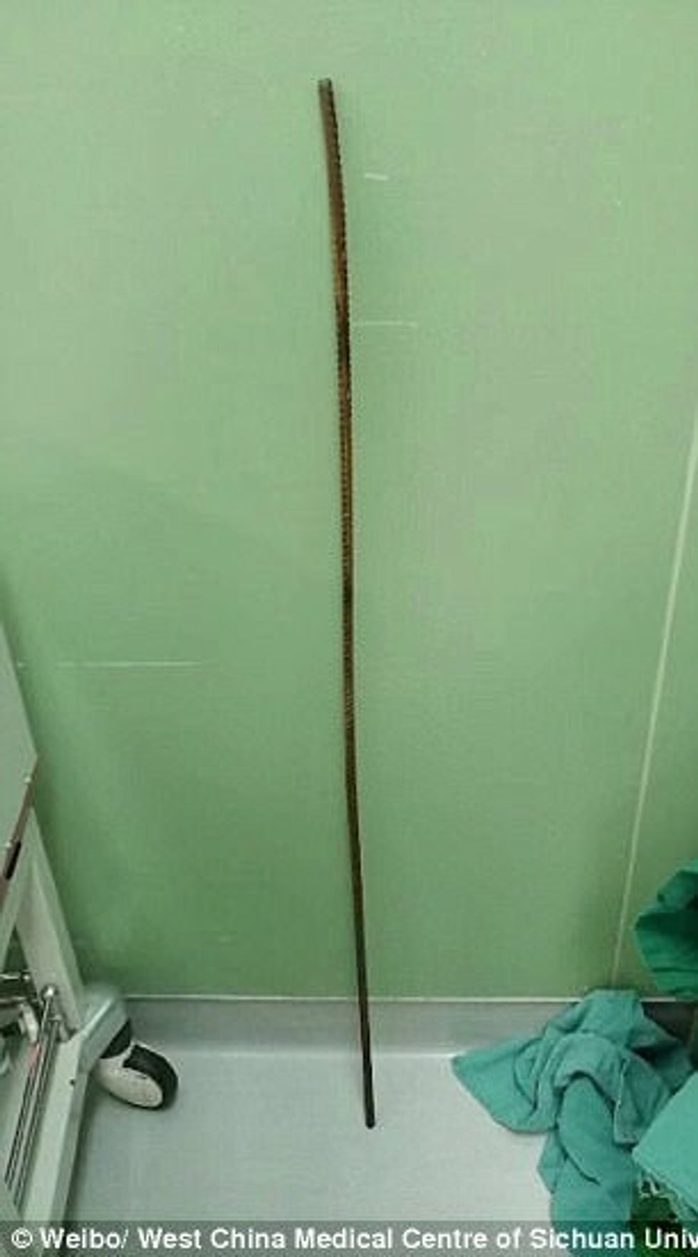 Ra në armaturën e gjatë dy metra pasi u godit nga vetëtima shpetoi pa shume lendime foto 3