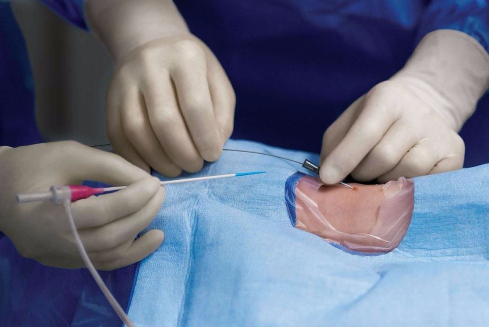 Radial Access Cath Lab Procedure