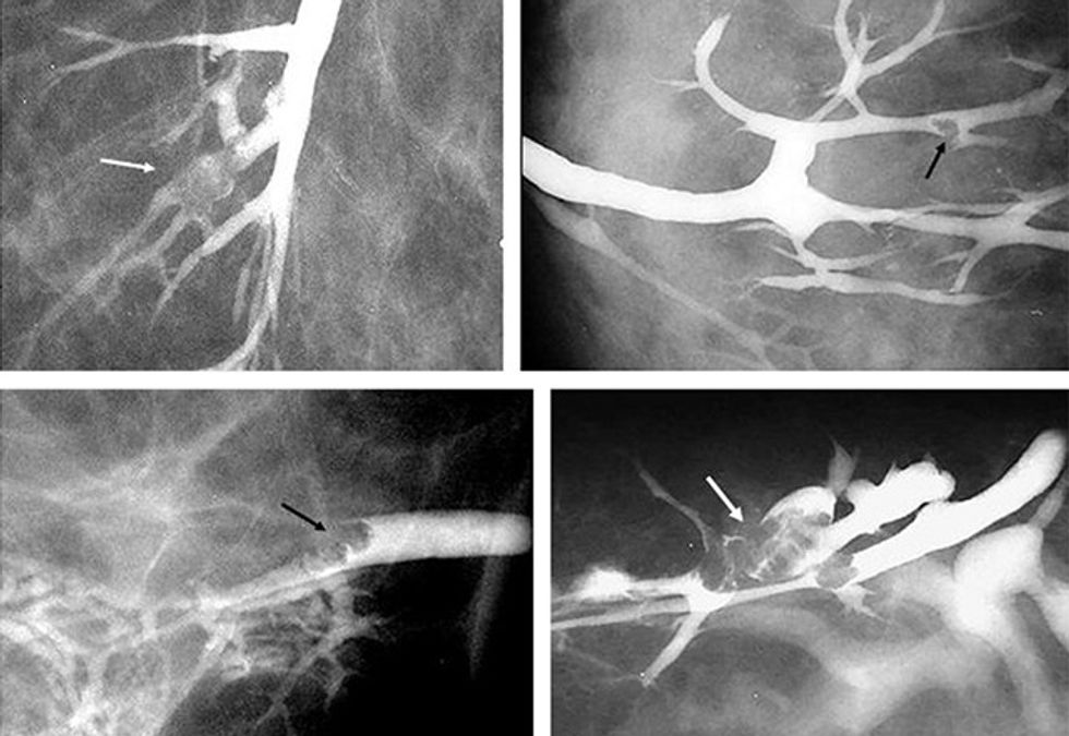 RadiologÃŁa. 10.1016/j.rx.2011.06.005