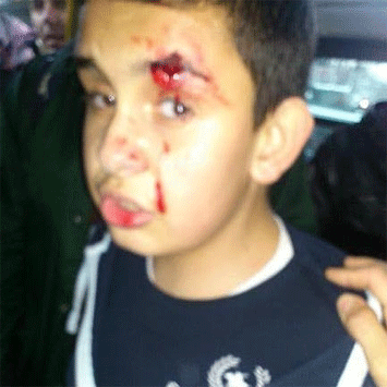 ramazan iseni 2