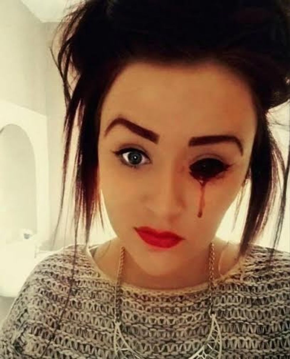 Recent pics of Marnie bleeding (3) (Large).jpg