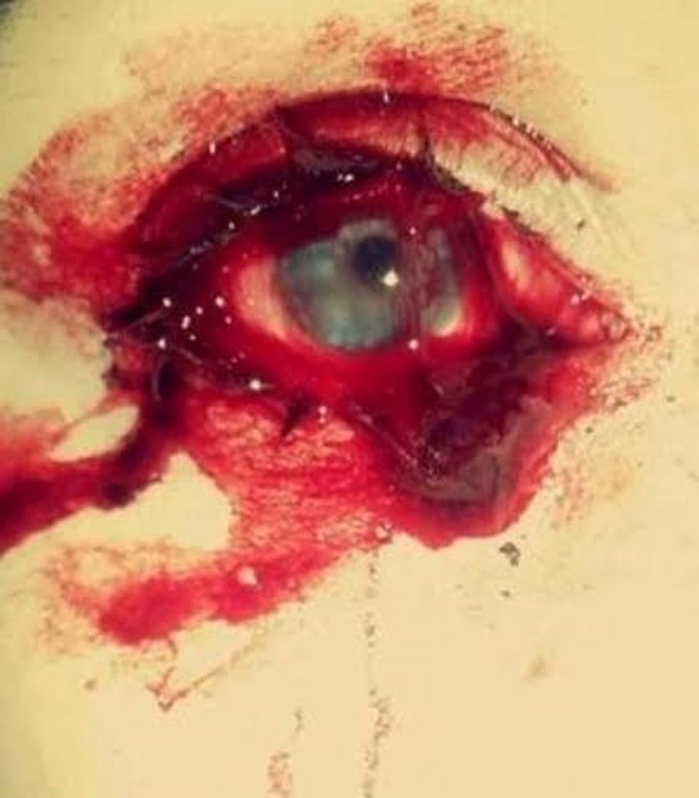 Recent pics of Marnie bleeding (4) (Large).jpg