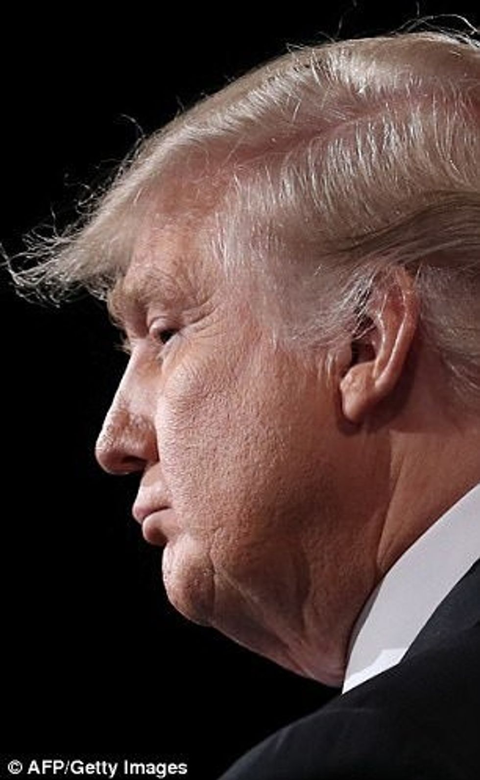 Reja e çuditshme që ngjanë me presidentin Trump foto 2