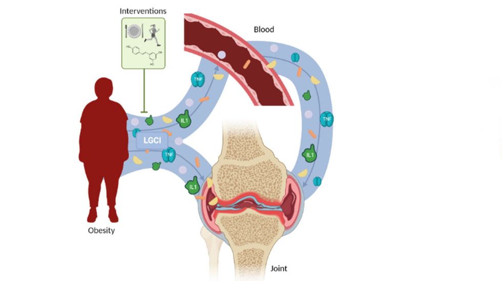 rheumato 02 00016 g001