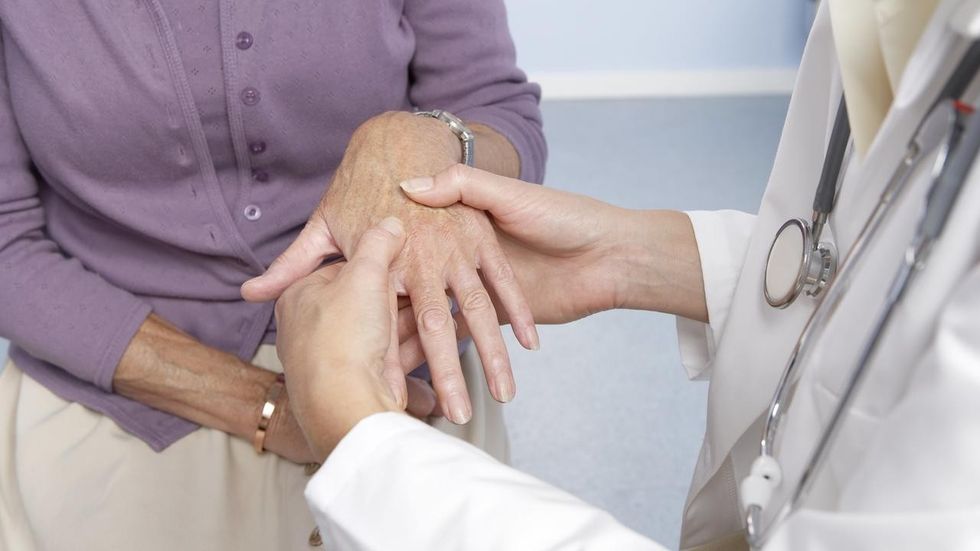 rheumatoid arthritis3