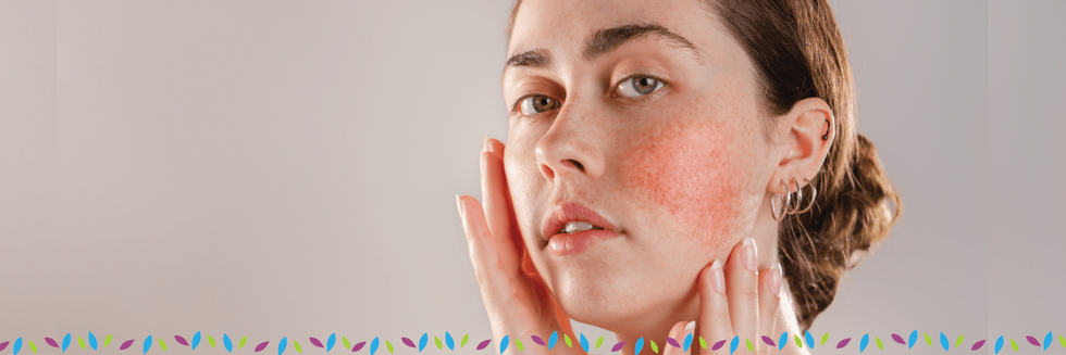 rosacea specialist phoenix az