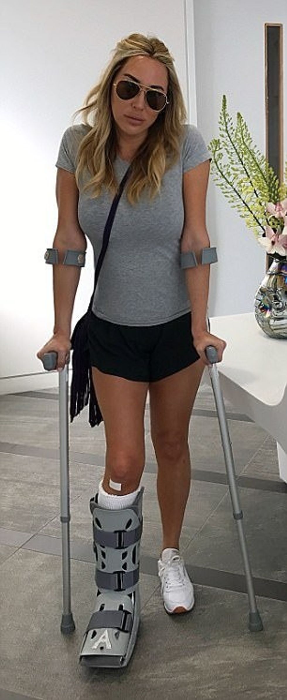 Rrahu tetë plaçkitës që donin tia vjedhnin oren theu kemben duke goditur njerin prej tyre foto 2