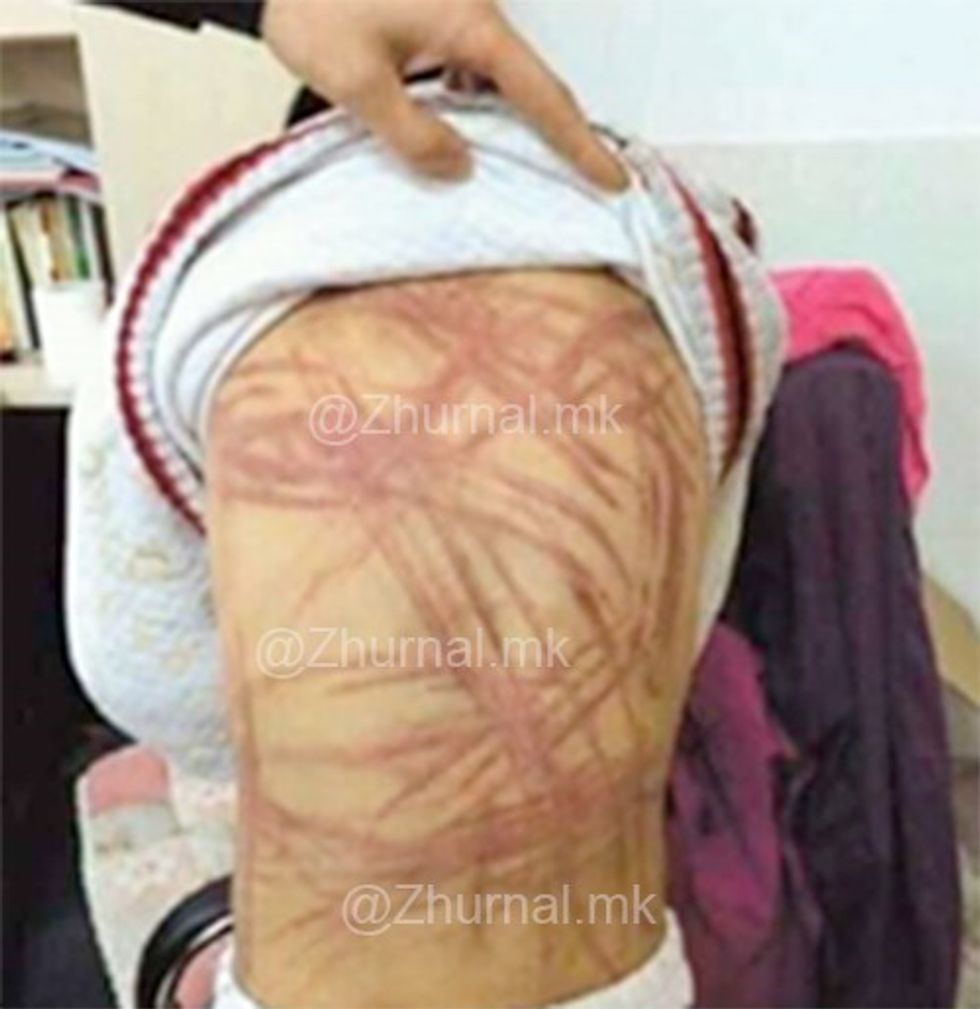 Rrihet i burgosuri shqiptar ne Idrizove