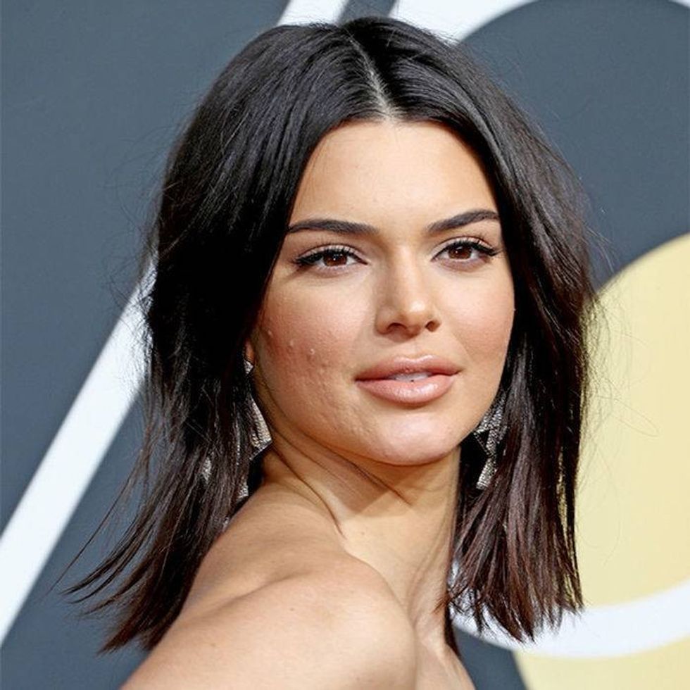 rs 180108175254 600 kendall jenner acne skin golden globes