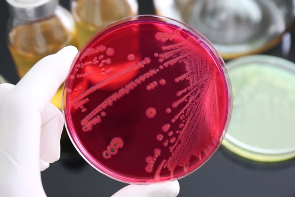 salmonella bacteria in petri dish 2