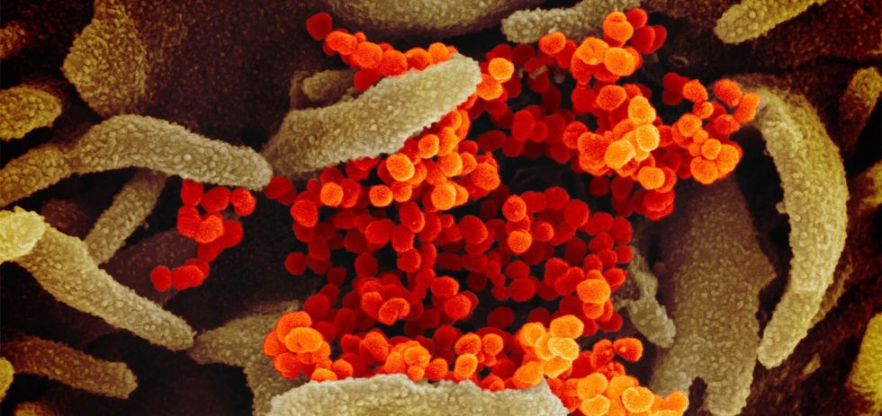 SARS CoV 2 coronavirus emerging from cells