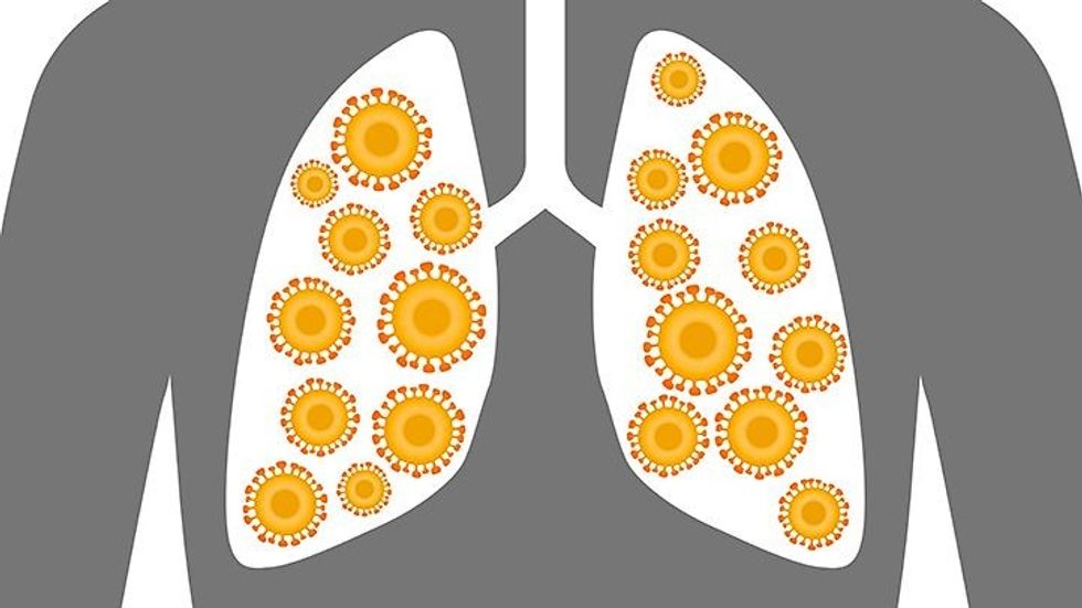 sg can the flu turn into pneumonia 1