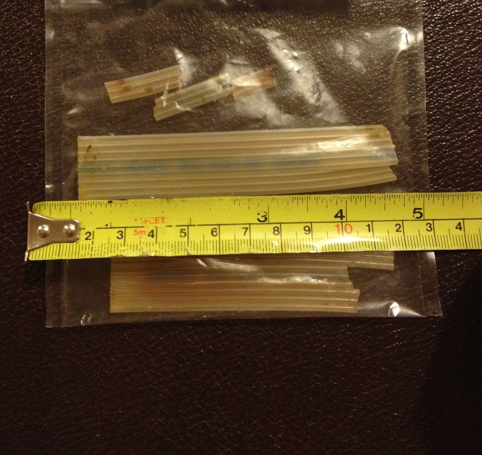 Shkaku i një shiriti që ia harruan gjatë operimit pati dhimbje barku per 20 vjet foto 2