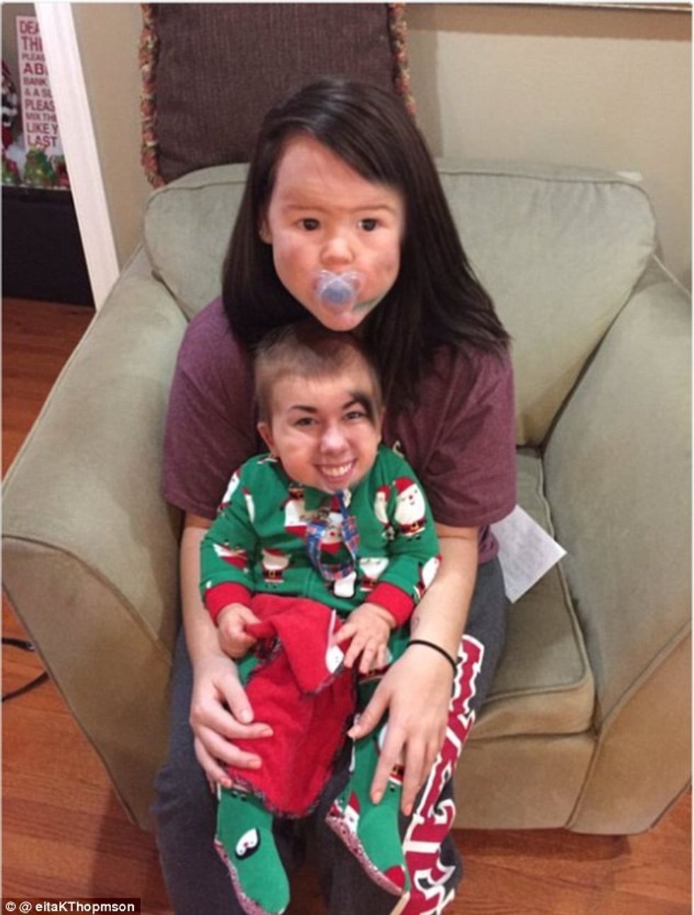 Shkëmbimet e fytyrave me rezultatet më të frikshme foto 9