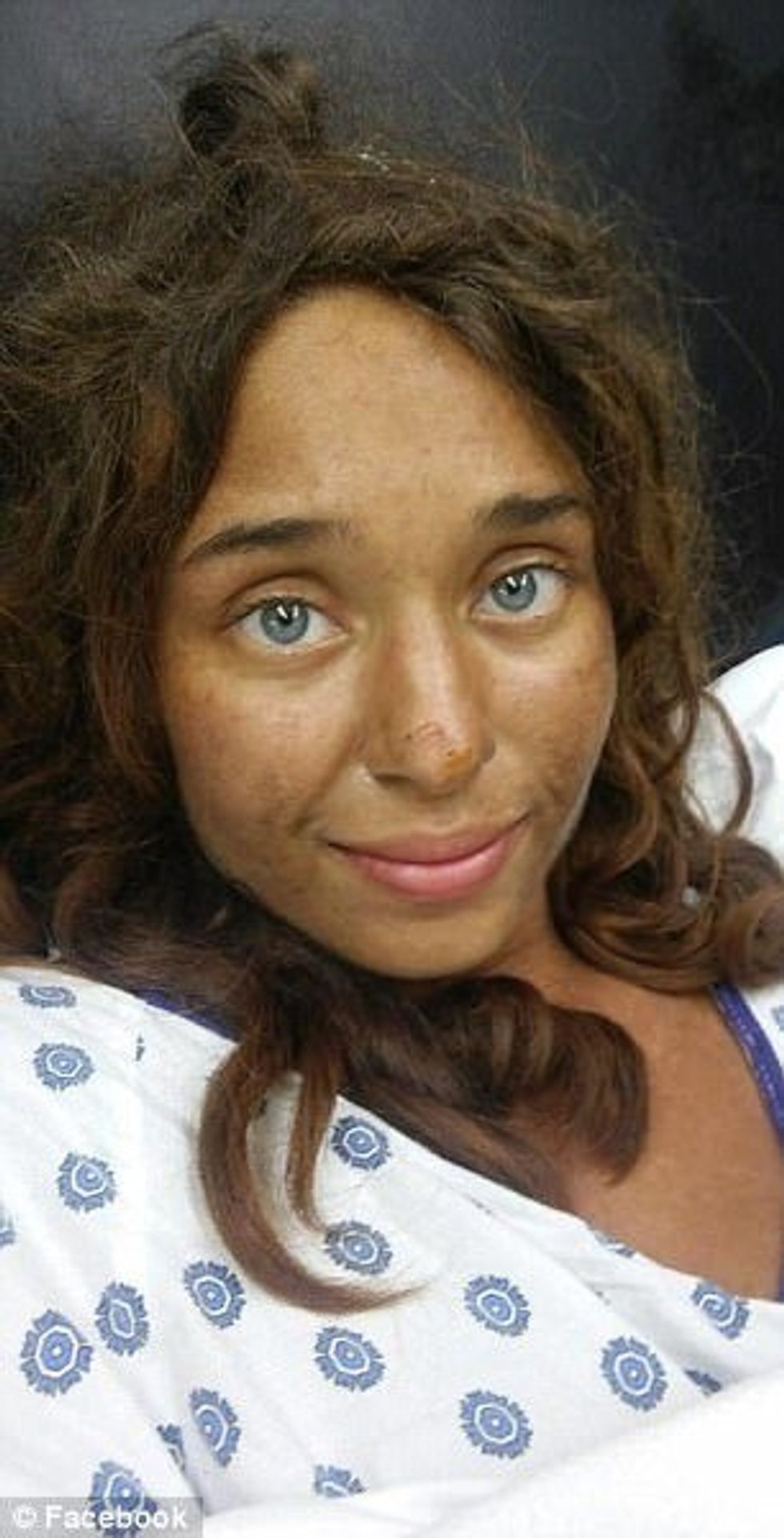 Shpëtoi për një muaj në mal duke ngrënë fruta dhe kërpudha foto 2