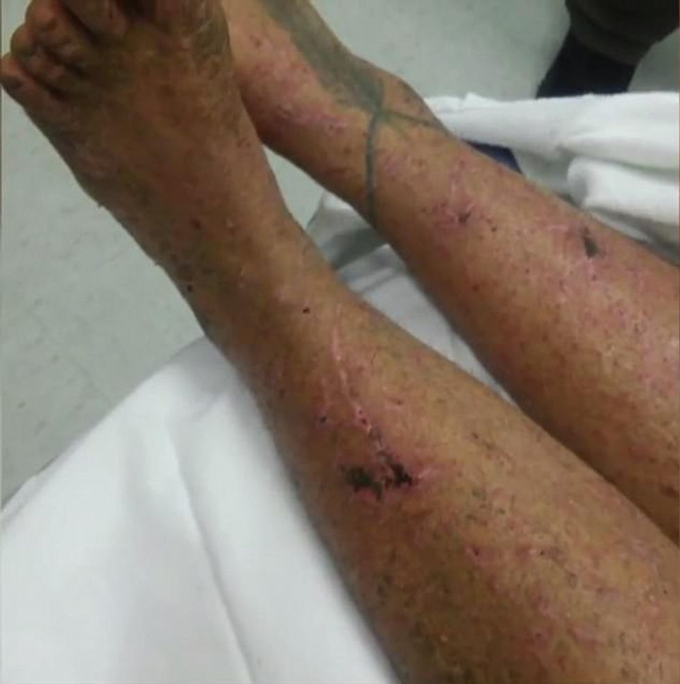 Shpëtoi për një muaj në mal duke ngrënë fruta dhe kërpudha foto 4