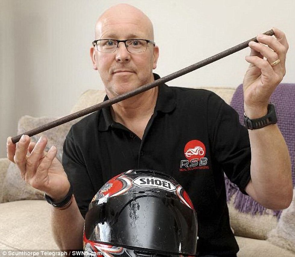 Shpëton mrekullisht pasi shpohet ne fyt nga nje shufer metalike foto 5