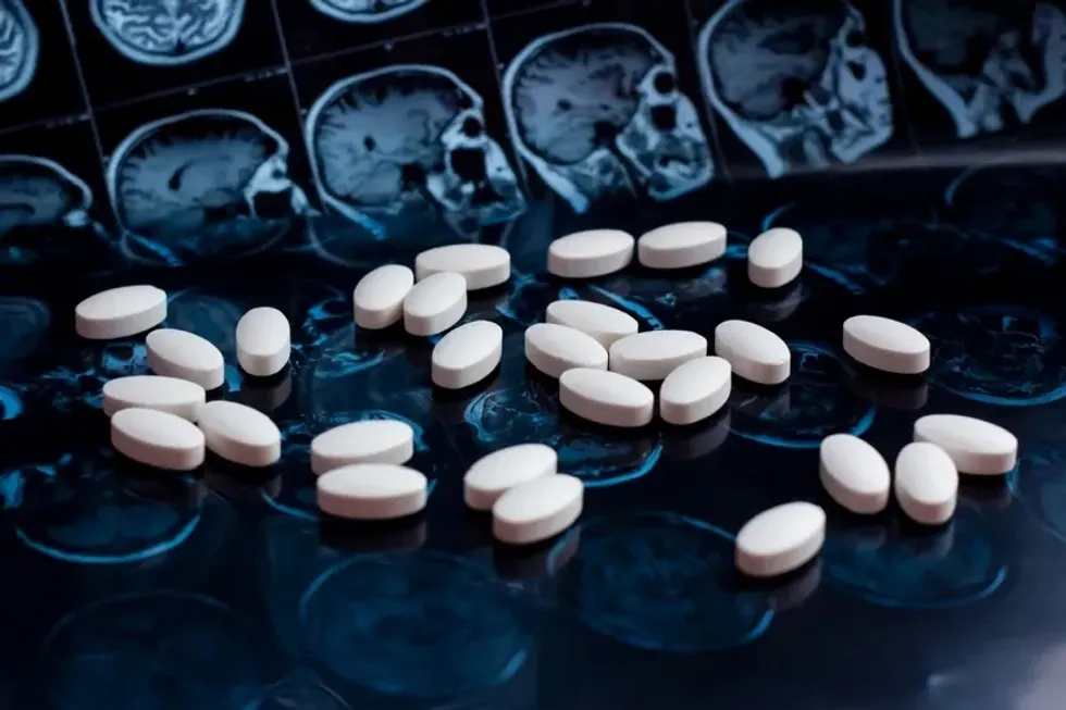 Ilaçi për diabet që përdoret prej dekadash ka një efekt të papritur edhe në tru