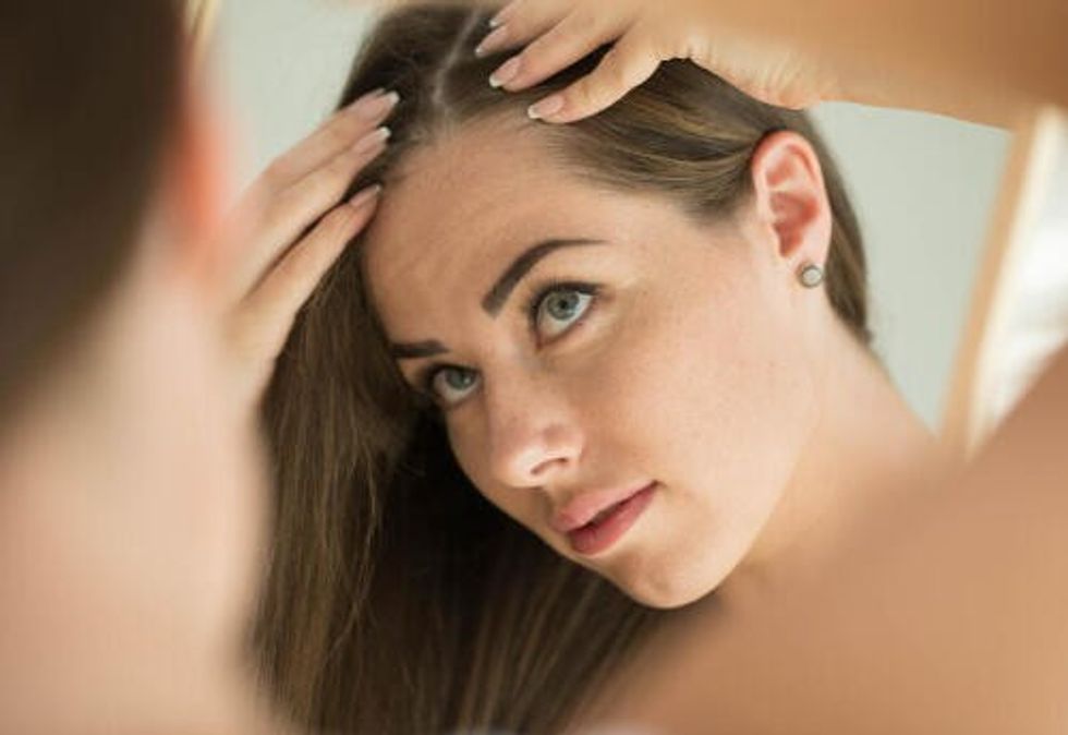 signs of thinning hair photo2 d