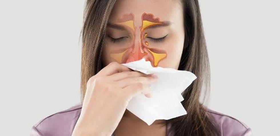 sinusite inflamacao seios da face 1578311139097 v2