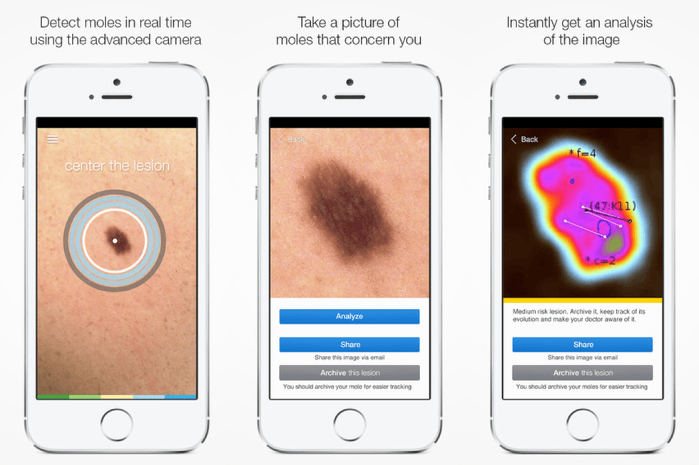 SkinVision App
