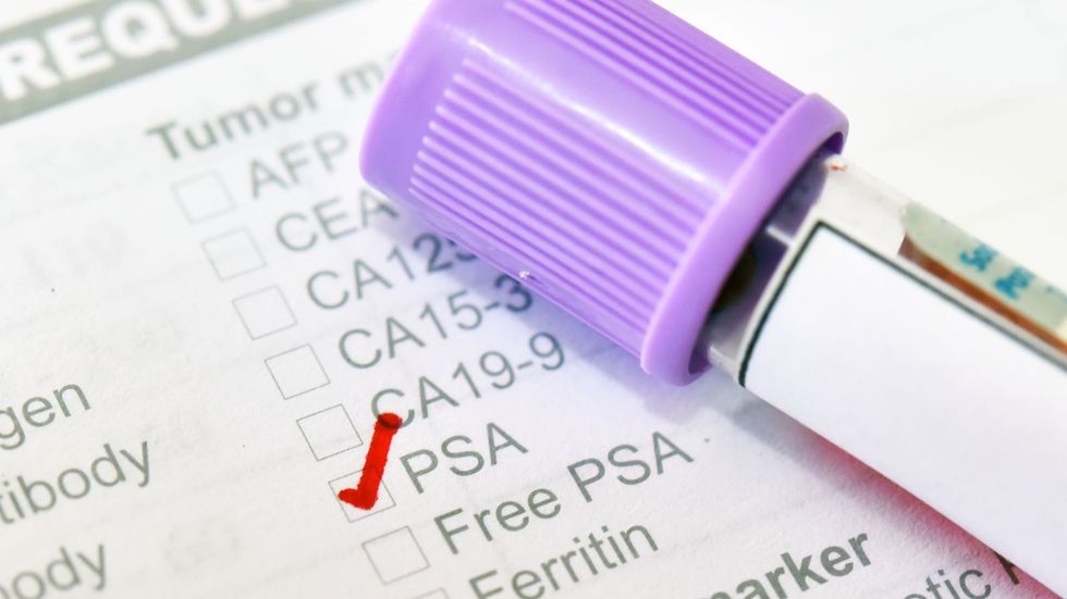 skynews psa testing prostate cancer 6715434