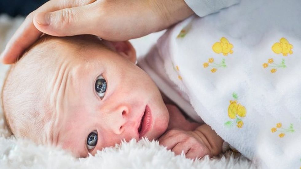 Soft Spots Cradle Cap and Funny Shapes All About Your Newborns Head