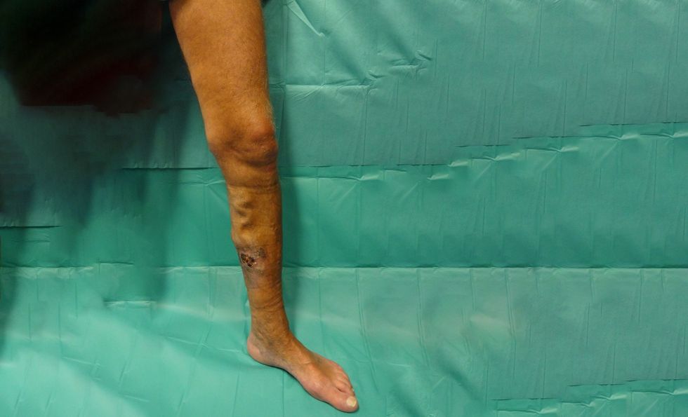 stad i avansuar i venave