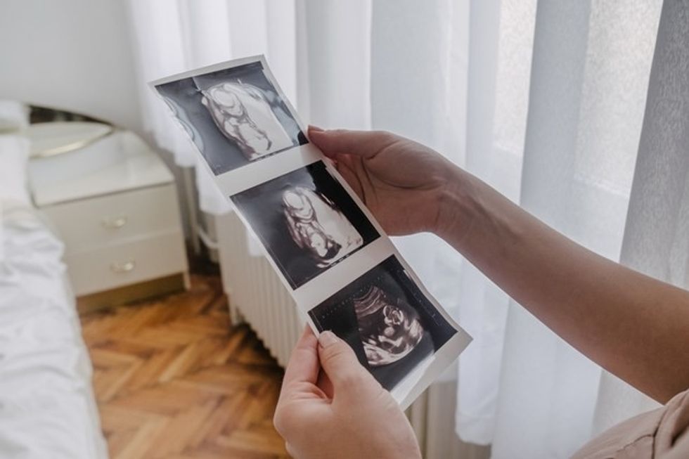 Stocksy txpm100 Medium 1729883