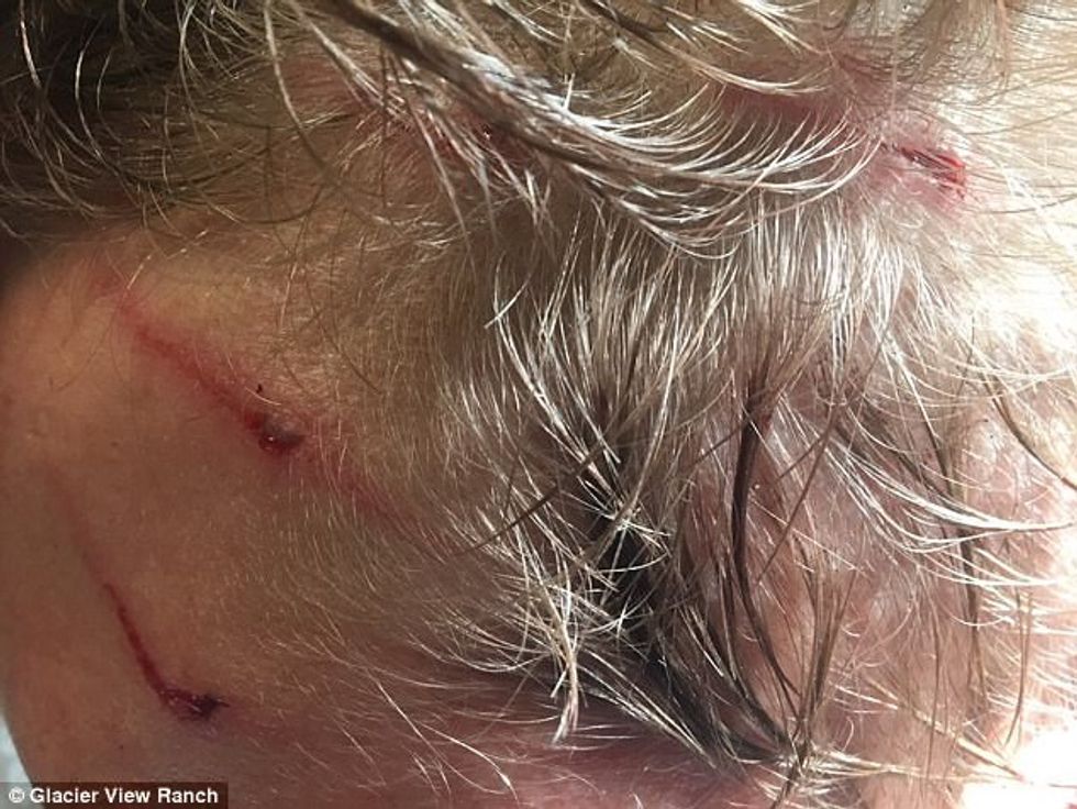 Sulmohet nga ariu derisa flinte në tendë shpeton me lendime te konsiderueshme foto 3