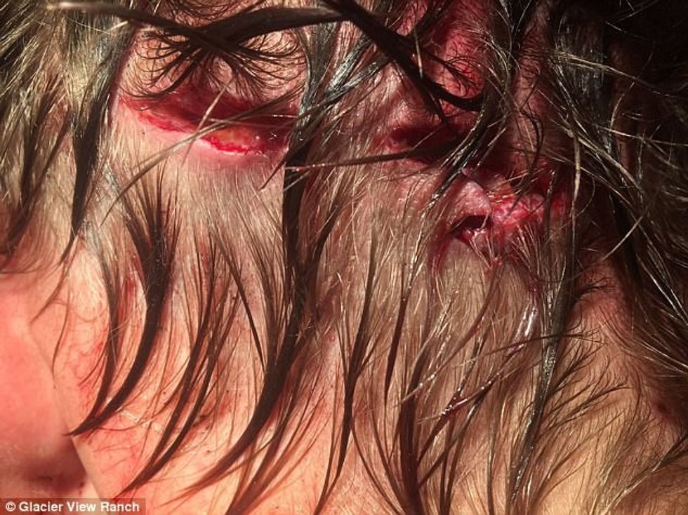 Sulmohet nga ariu derisa flinte në tendë shpeton me lendime te konsiderueshme foto 4