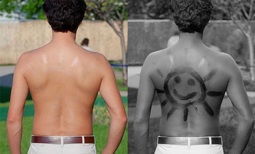Sunscreen_on_back_under_normal_and_UV_light