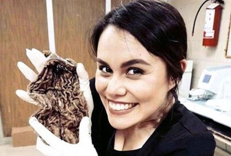 Suspendohen shkaku i fotografive me këmbën e amputuar foto 3