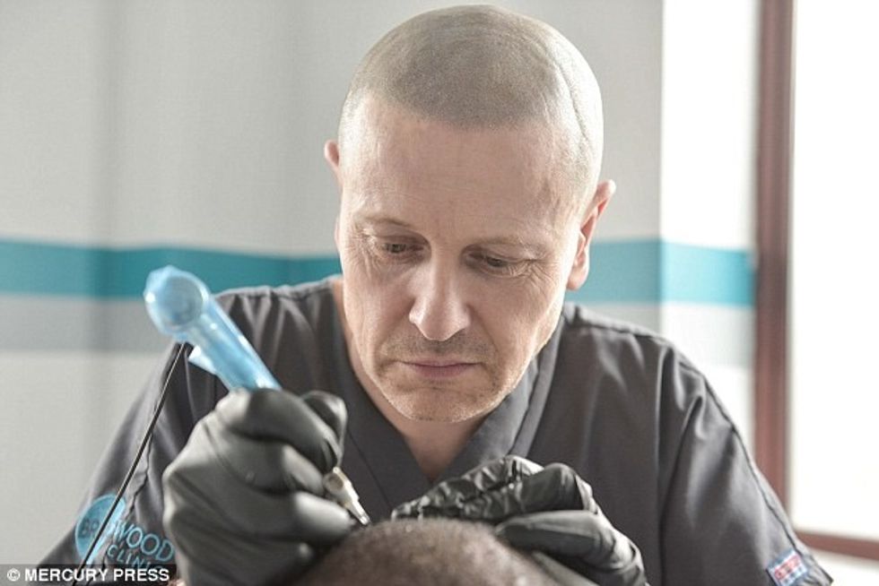 Tatuazhi që imiton flokët i ktheu vetëbesimin tullacit foto 3