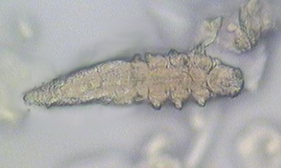 Te gjithe kemi ne fytyre krijesa te tilla foto 2