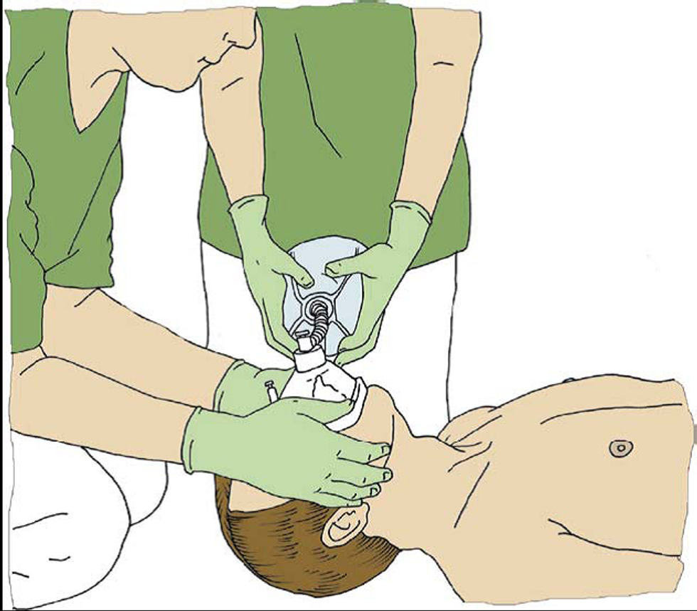 Teknika e ventilimit me dy shpetimtare