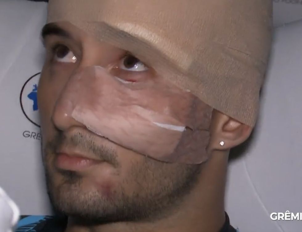 The attack on Gremio's bus left multiple players injured