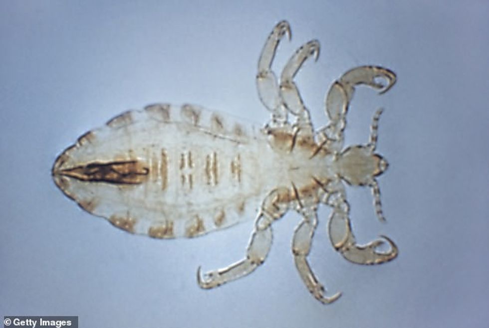 The feces of body lice is what transmits trench fever, which causes relapsing fever, bone pain (especially in the shins), headaches, nausea, vomiting and malaise
