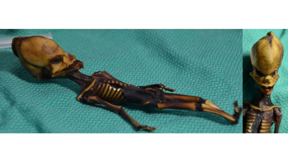 The mummified specimen from Atacama region of Chile.