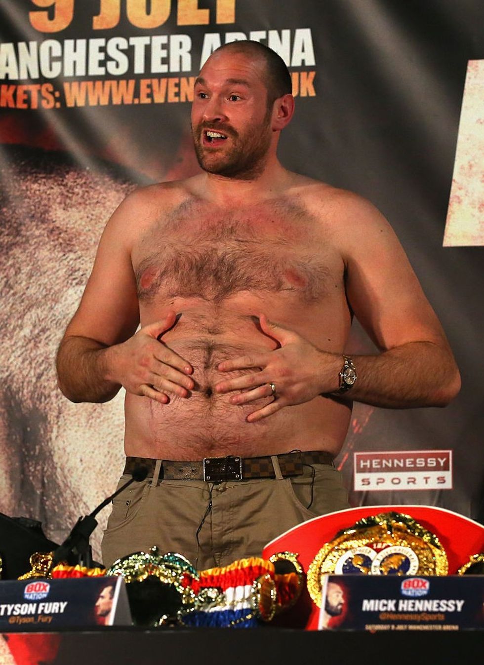 TysonFury