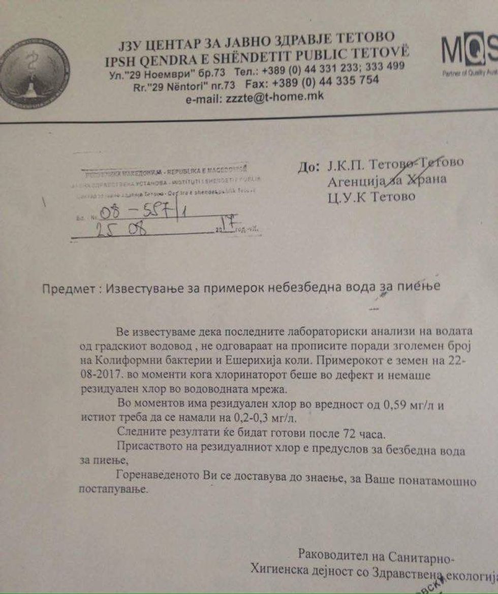 uji nuk pihet tetove