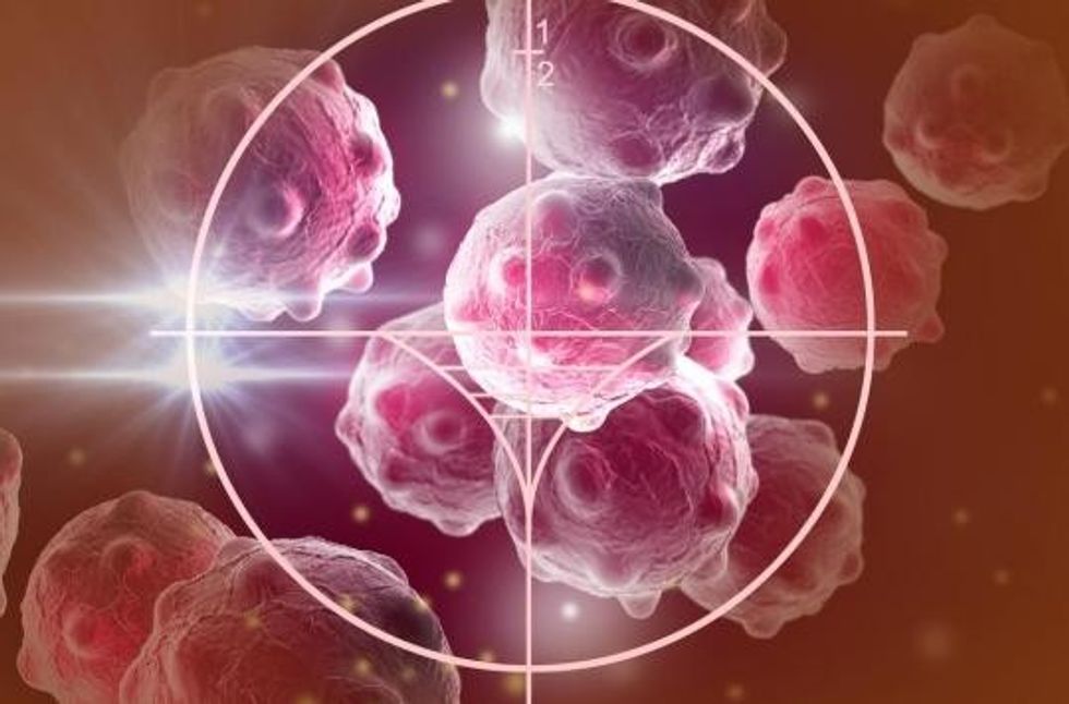 uploded istock 526212629 1522326315