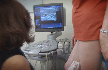 Venous Duplex ultrasound of