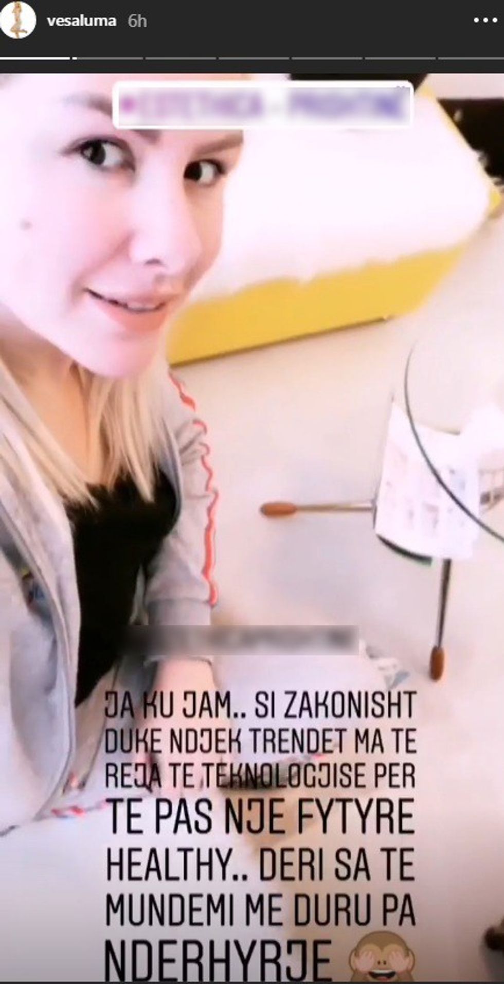 vesa2