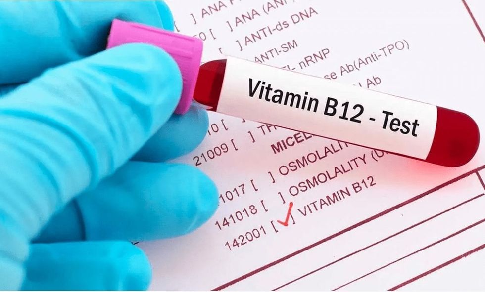 Vitamin B12