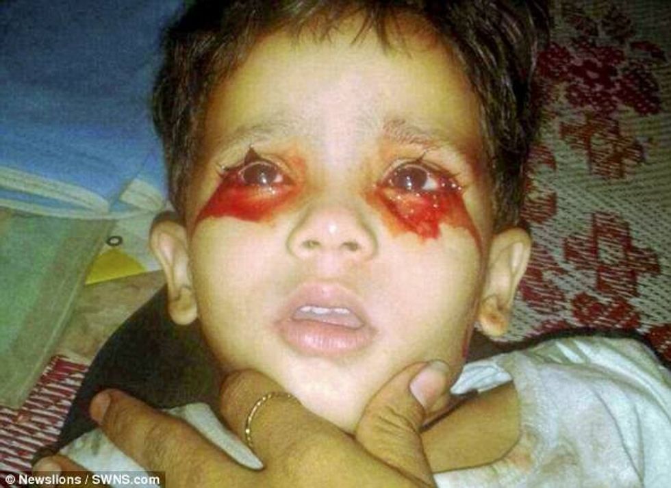 Vogëlushja befason mjekët sa here qane i rrjedhe gjak nga syte foto 2