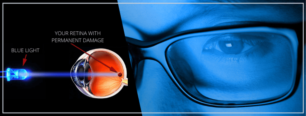 Ways to Protect Your Eyes from Blue Light Damage