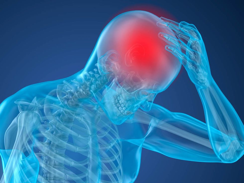 what is massive stroke